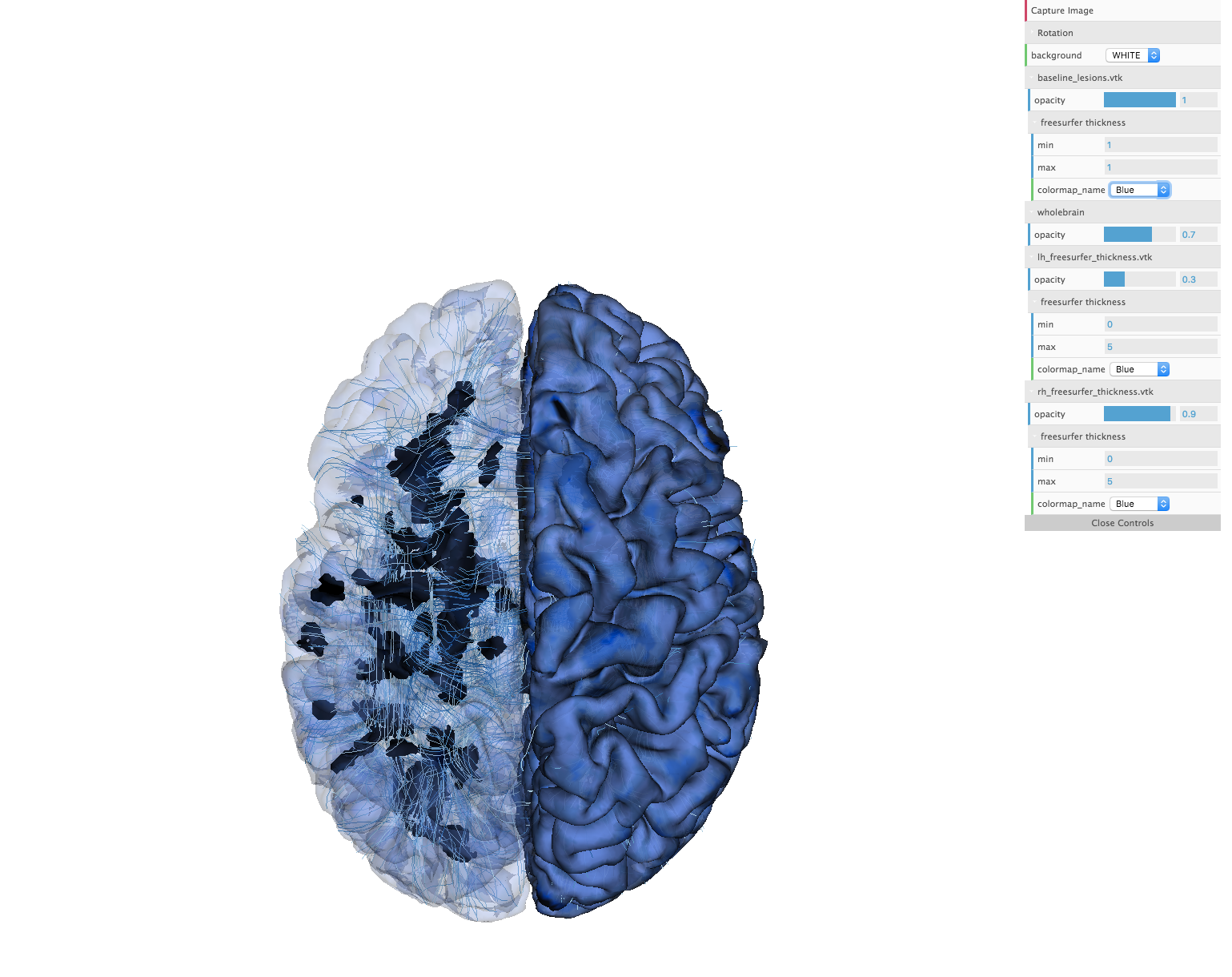 Three dimensional processed MRI